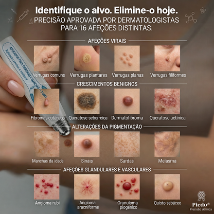 💖💖 𝐏i𝐜𝐝o® Eliminador de Marcas e Manchas em 7 Dias (Roll-on Sem Dor e Sem Cicatrizes)