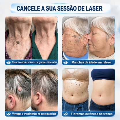 💖💖 𝐏i𝐜𝐝o® Eliminador de Marcas e Manchas em 7 Dias (Roll-on Sem Dor e Sem Cicatrizes)